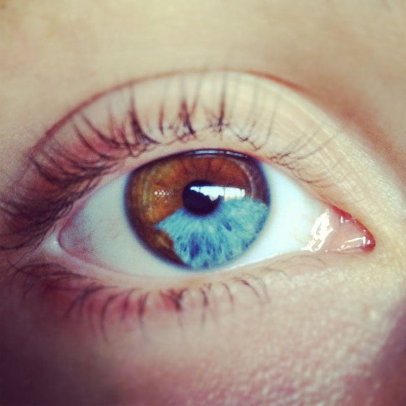 Hermosas mutaciones 15 heterocromia12 fotos impresionantes