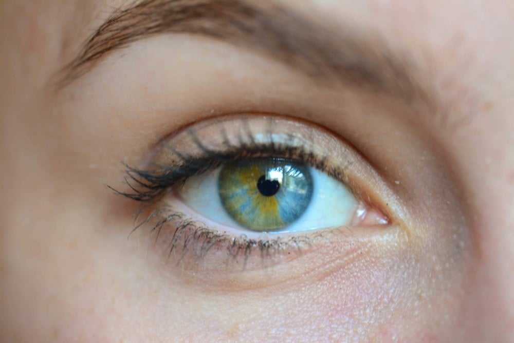 Hermosas mutaciones 15 heterocromia8 impresionantes fotos
